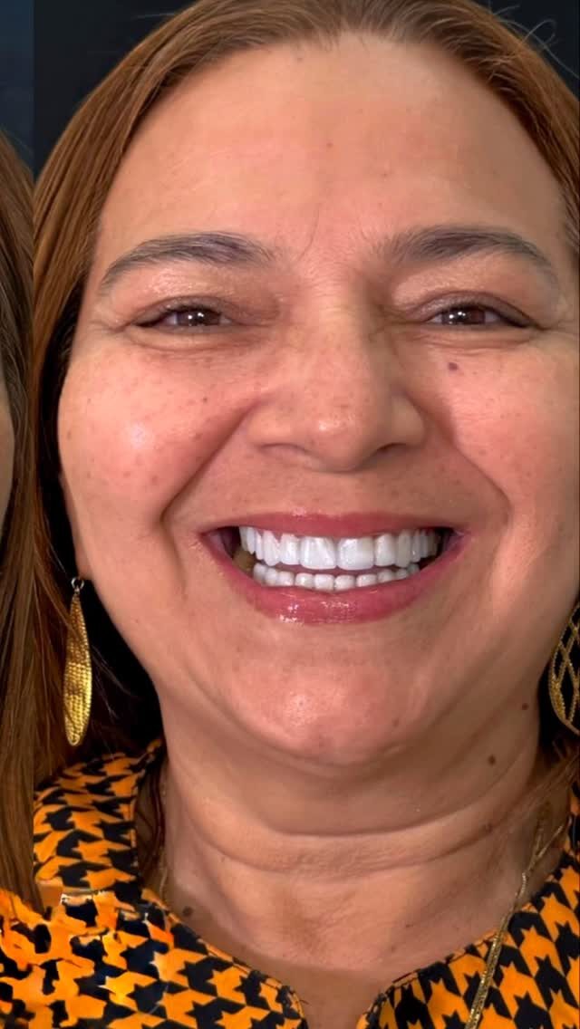 Paciente sorrindo após tratamento